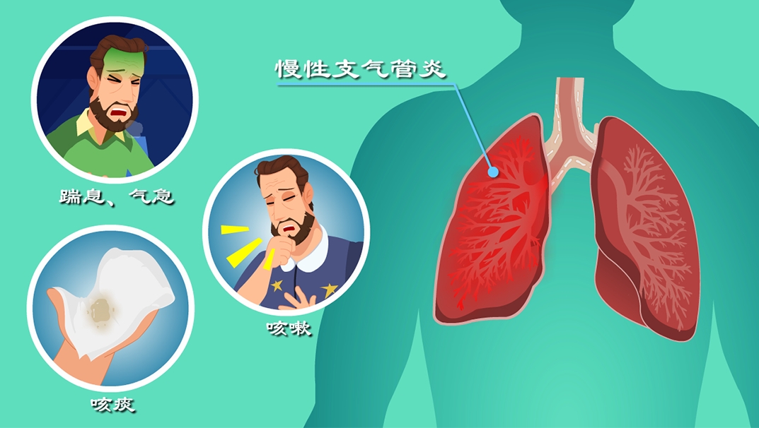 慢性支氣管炎的病因